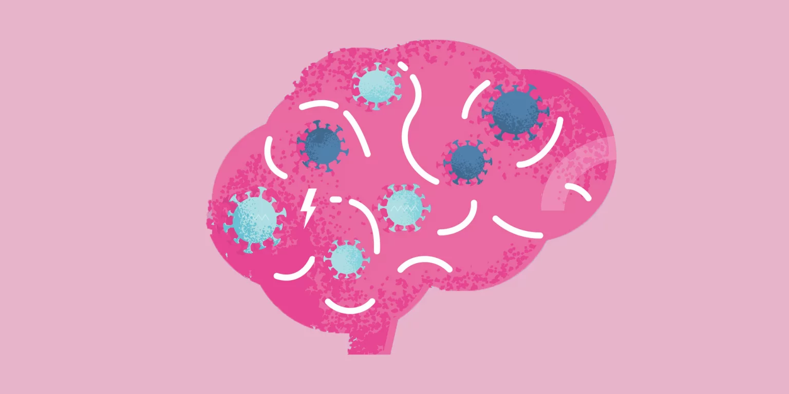 Attaque du cerveau par le Covid19 expliquer les syndromes