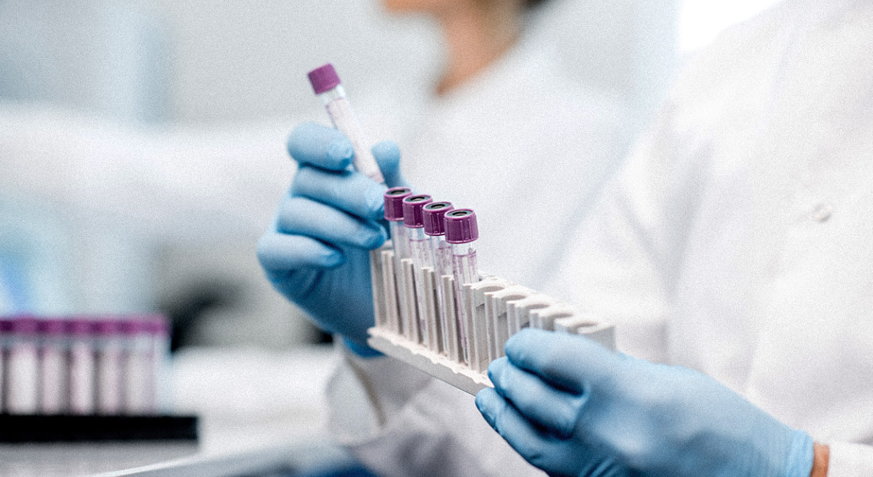 Laboratory assistant putting test tubes into the holder, close-up view focused on the tubes. 