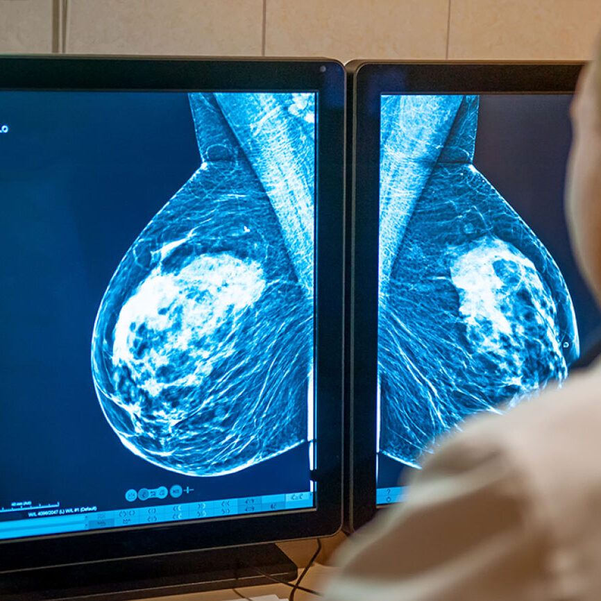 Pict-Breast-center-test-2 Pict-Breast-center-test-2